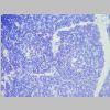 Pancreas SF 22.jpg